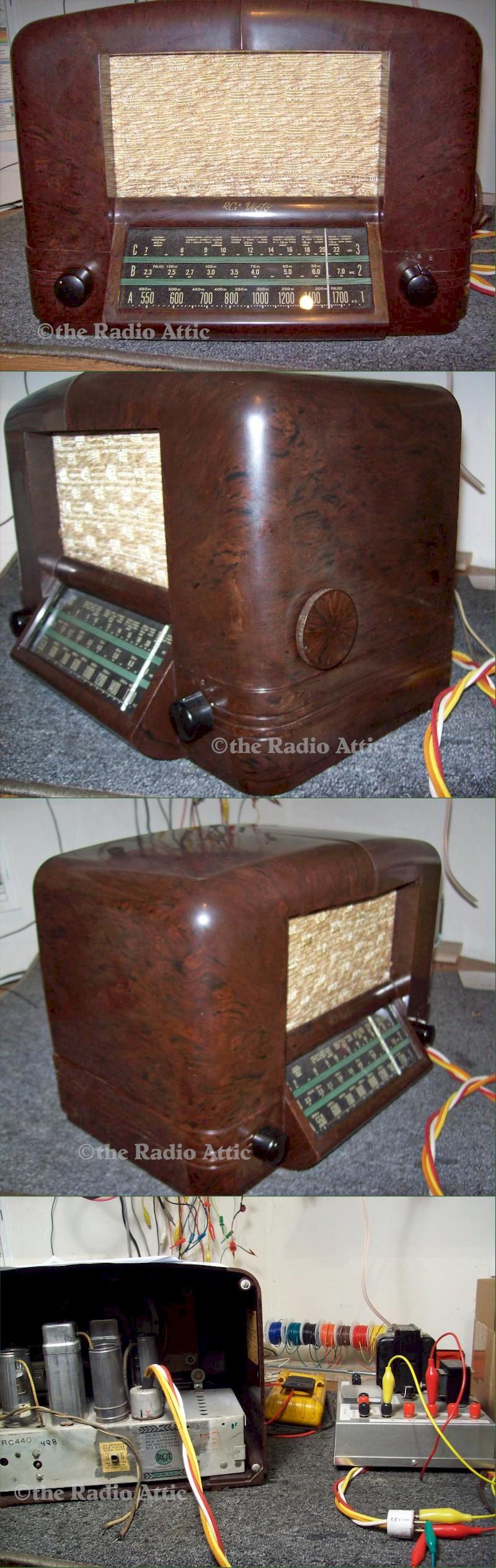 RCA 4QB Battery Radio (1940)